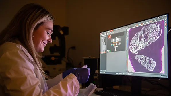 SIU Microbiology student examines sample on computer